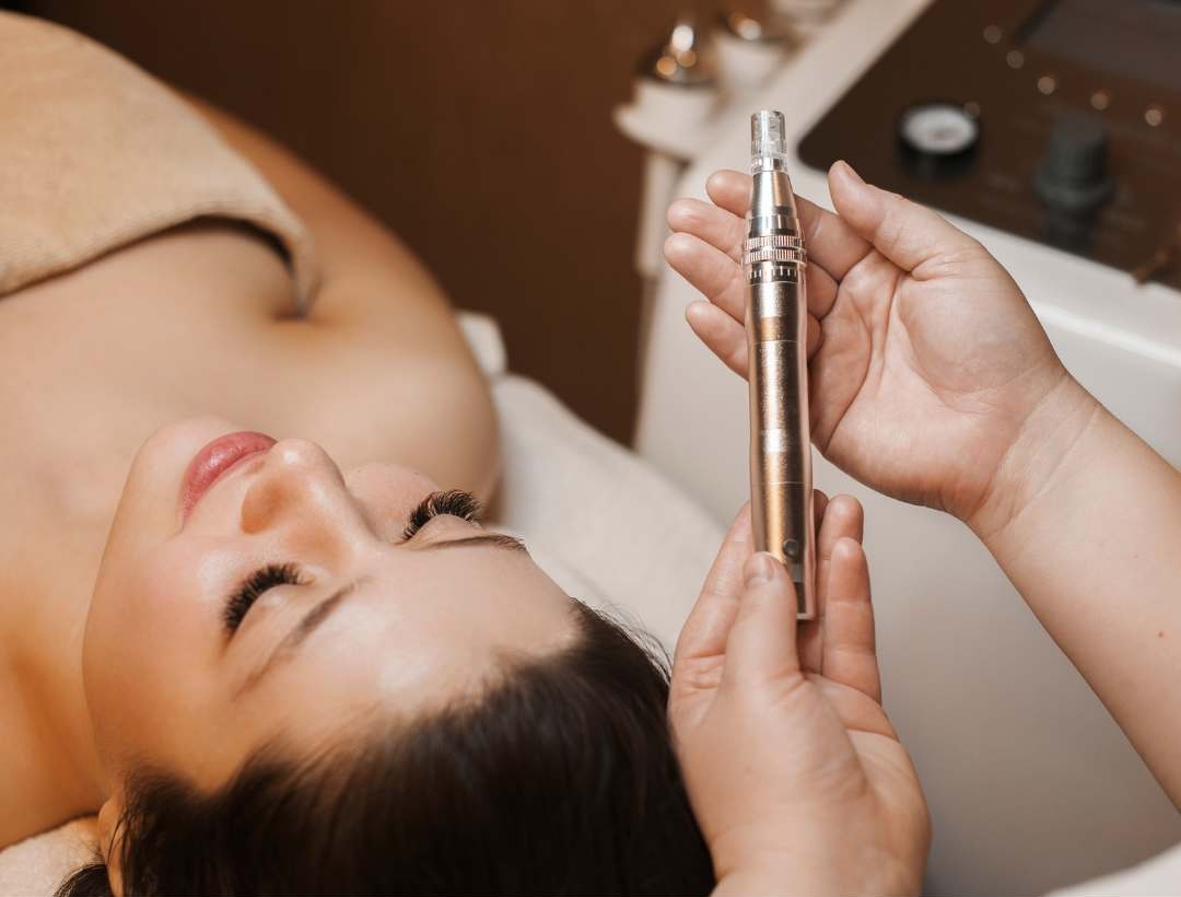 Microneedling with PRP and PRFM