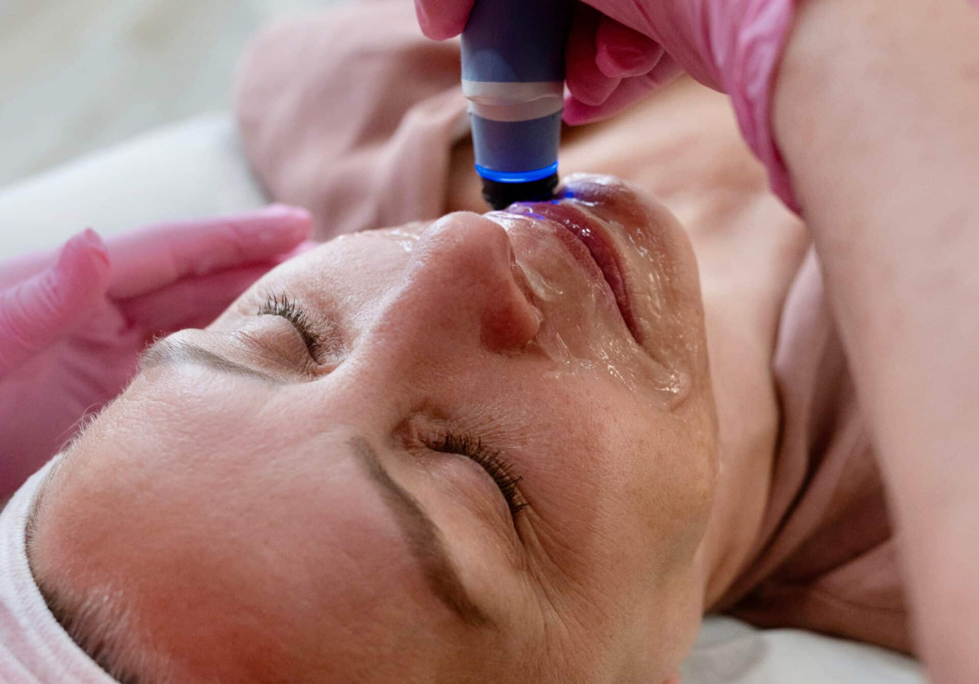 1770429217_Exion-Targeted-Ultrasound-Treatment-Image