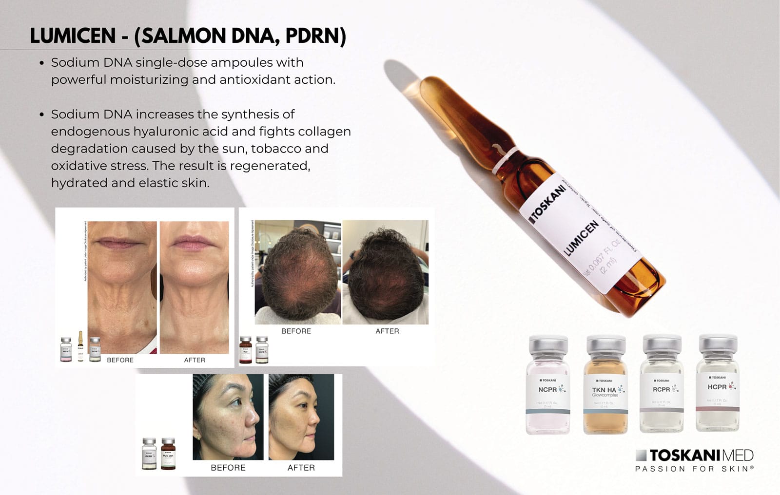 1770429585_about-polynucleotide-by-toskani