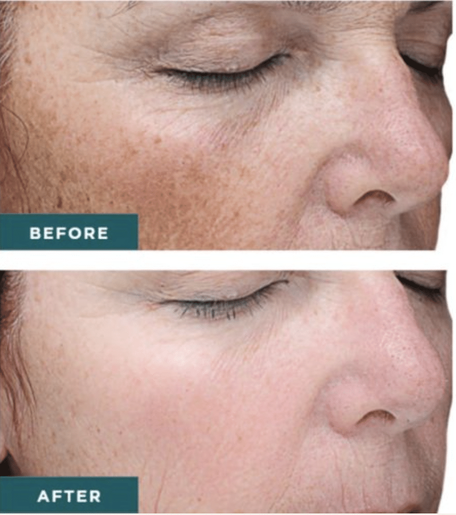 1770429927_49fd4dbf6fc04f4da3d4ad605e7ae0db