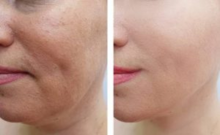 1770430500_salmon-rdna-aging-vs-300x185-1 (1)