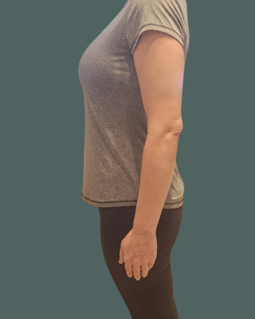 After Image: Semaglutide, Weight Management & Peptides - left-side