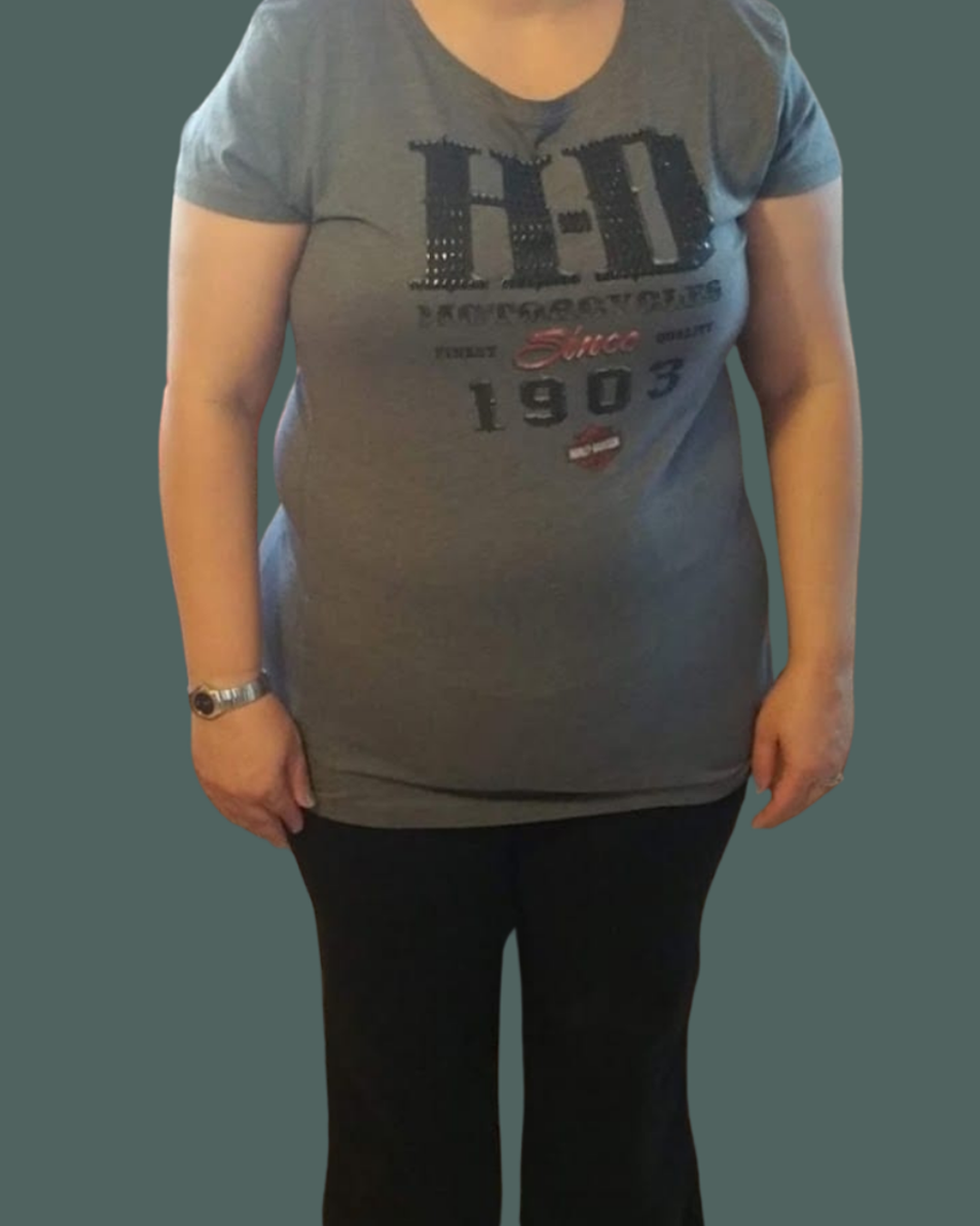 Before Image: Semaglutide, Weight Management & Peptides - front