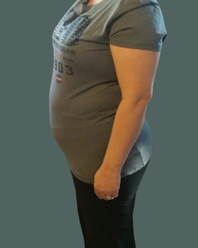 Before Image: Semaglutide, Weight Management & Peptides - left-side