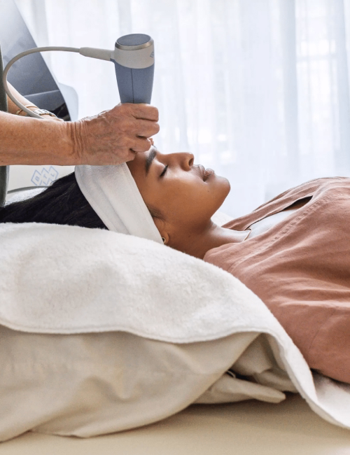 Exion® RF Microneedling Face