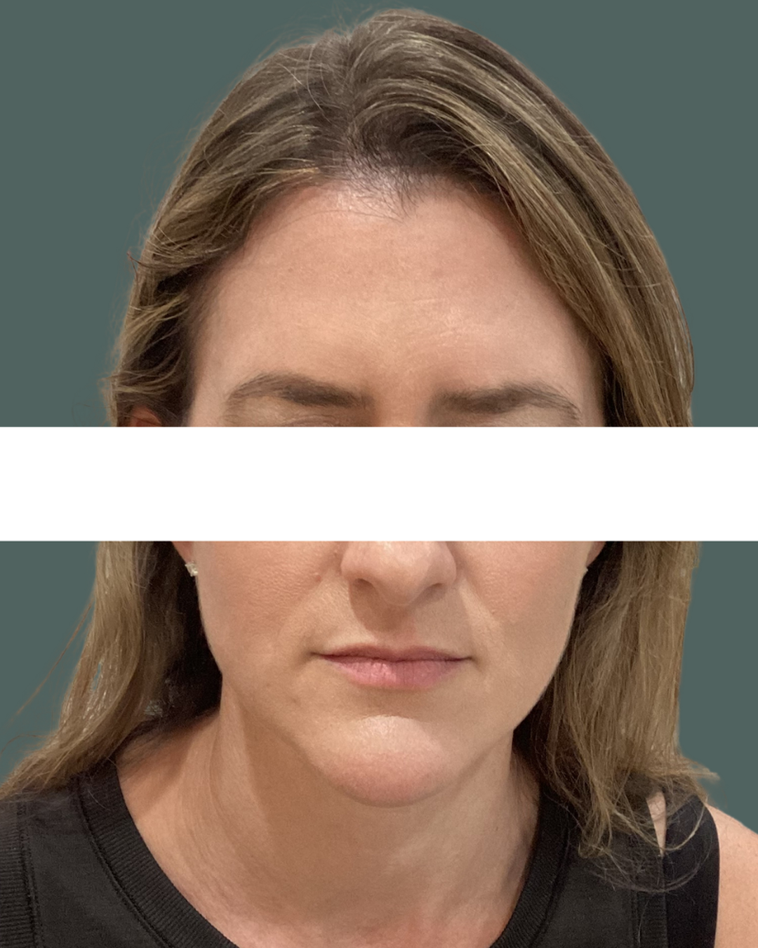 After Image: Neurotoxin - front