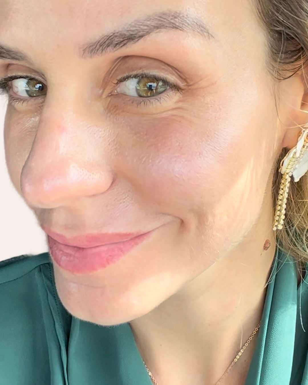 After Image: VI Peel - left-front-oblique