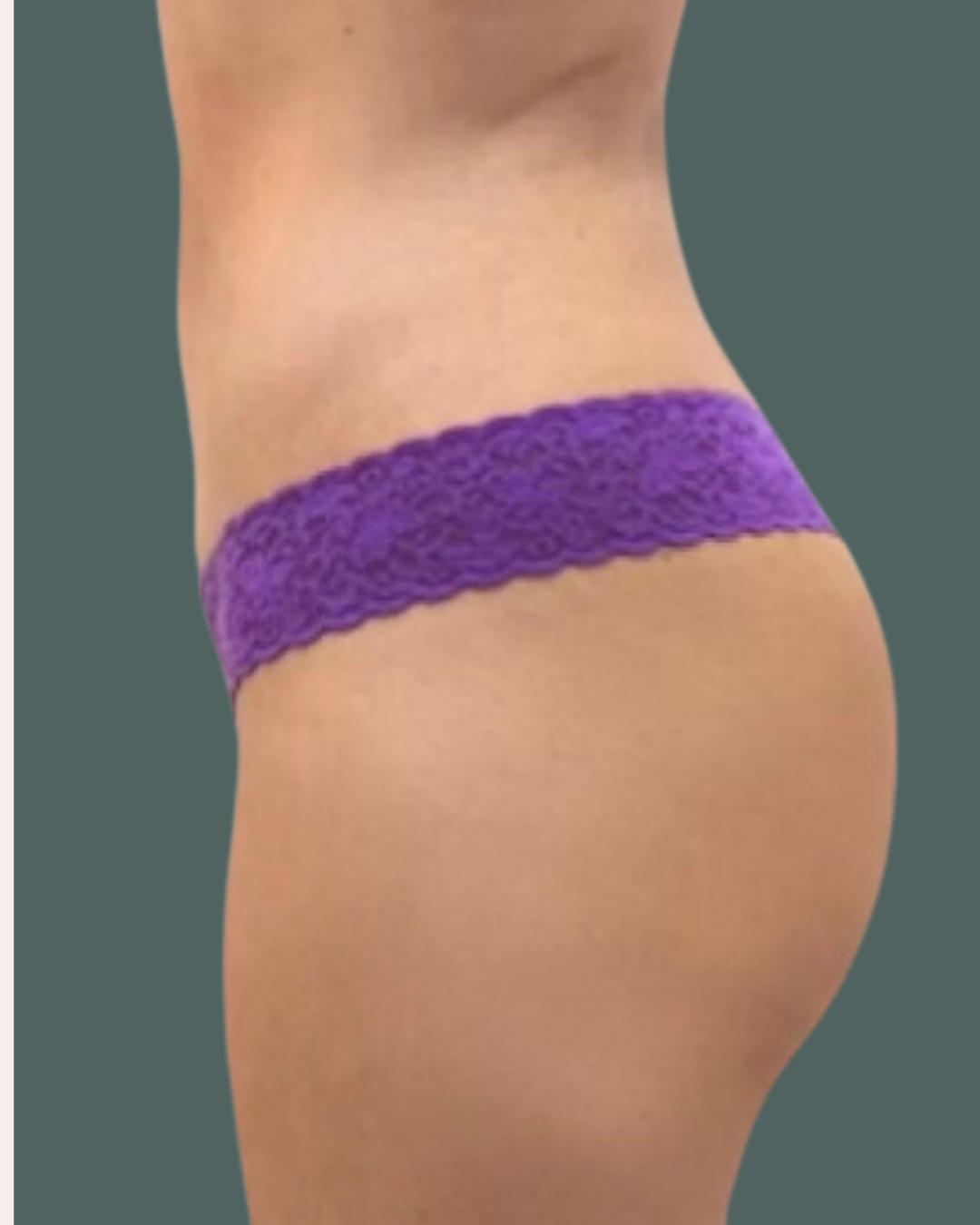 After Image: Maternal Reset - left-side