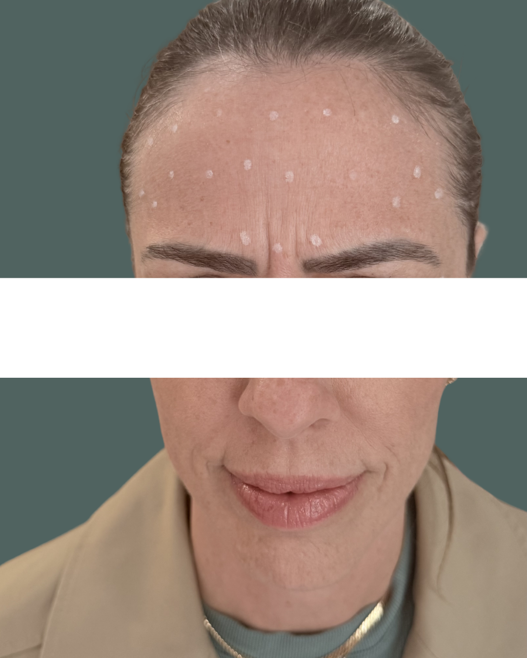 After Image: Neuromodulators - front