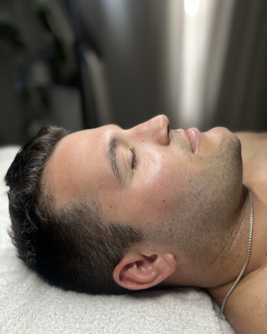 After Image: Facial - right-side