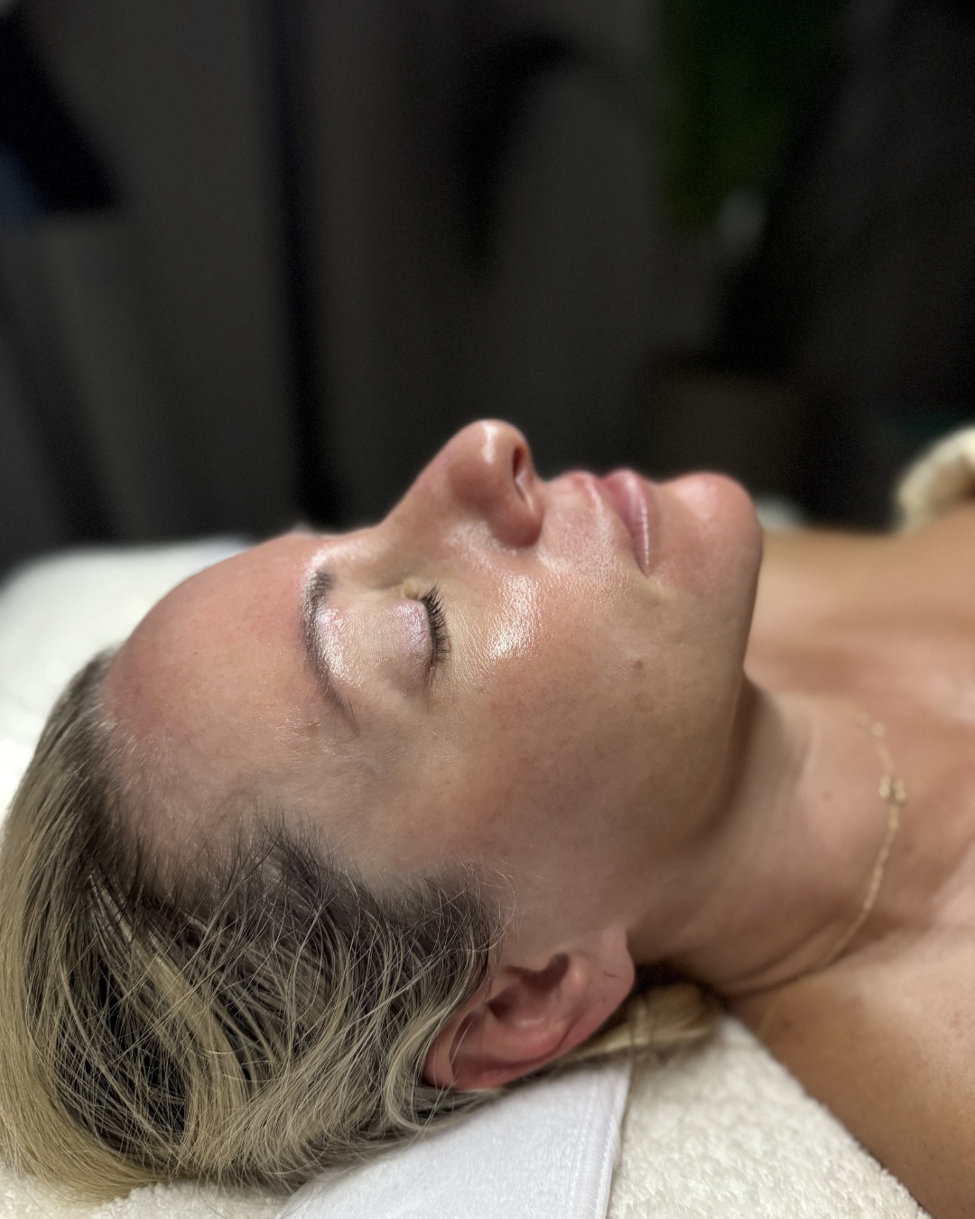 After Image: Facial - right-side