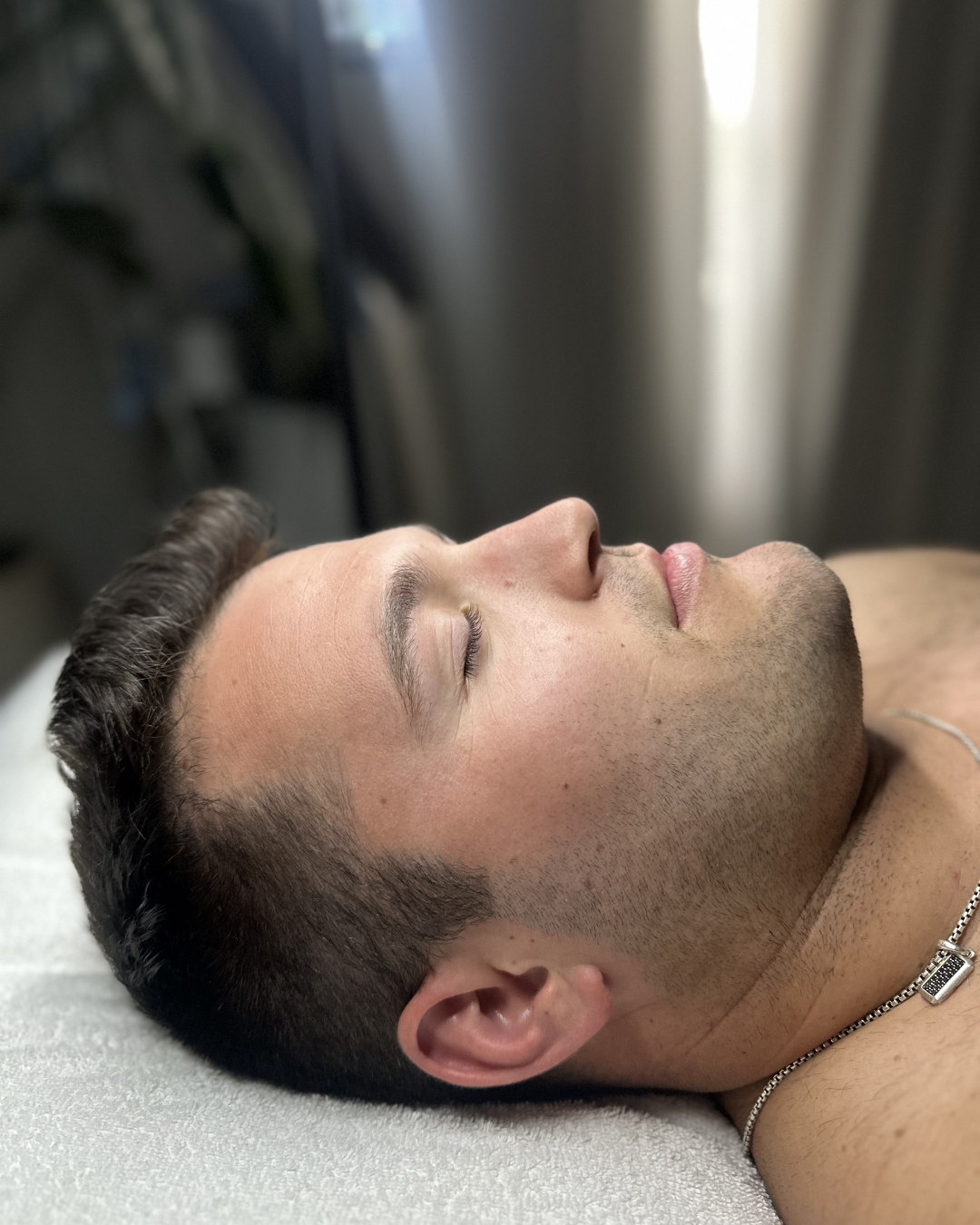 Before Image: Facial - right-side