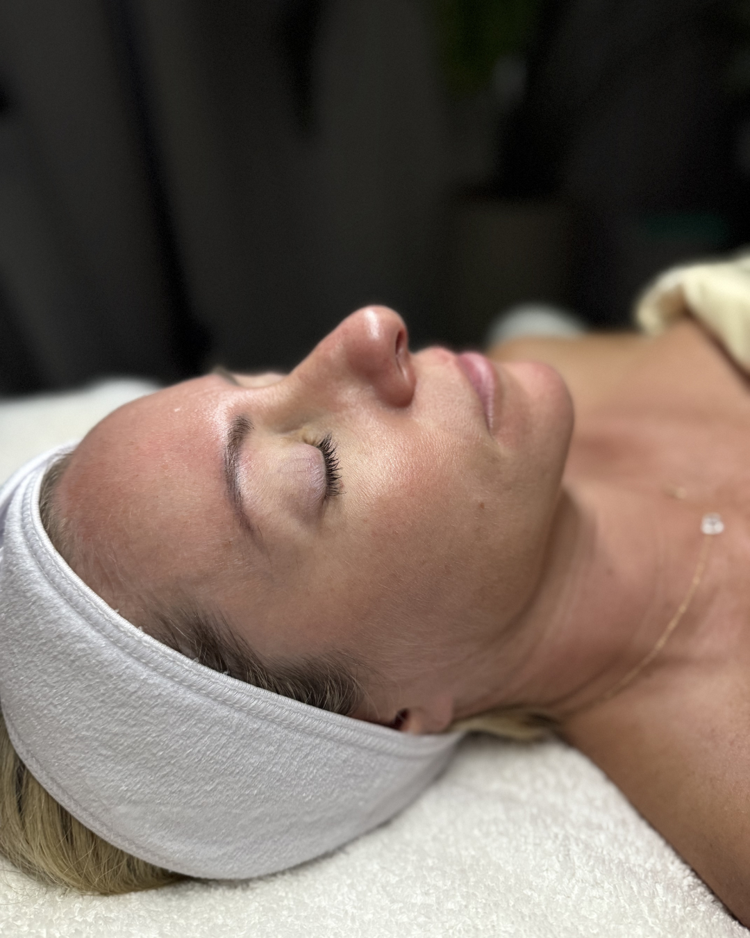 Before Image: Facial - right-side