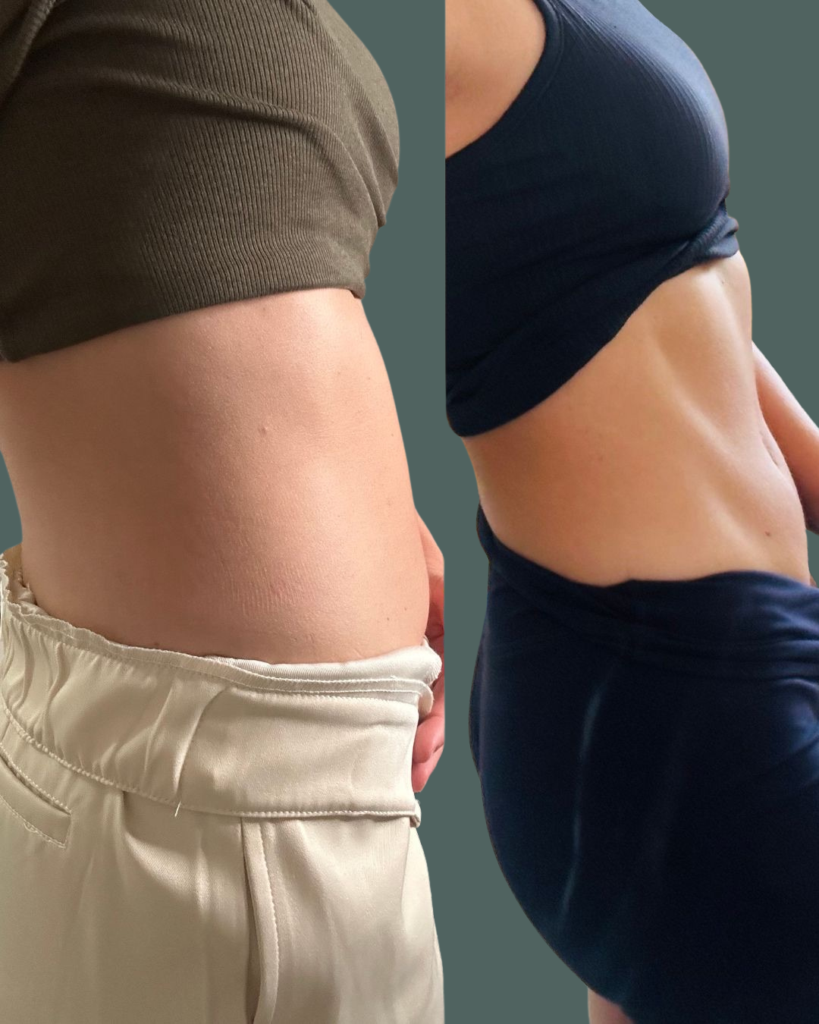 Before and After Image: Maternal Reset - right-front-oblique