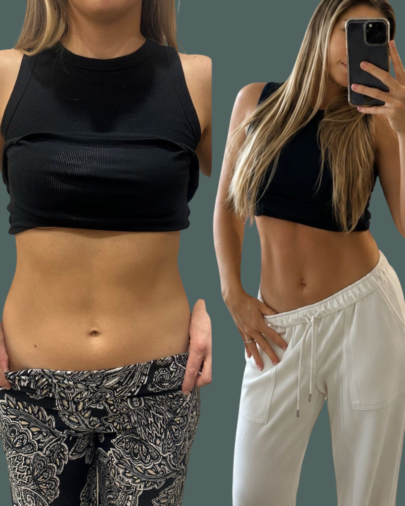 Before and After Image: Maternal Reset - right-front-oblique